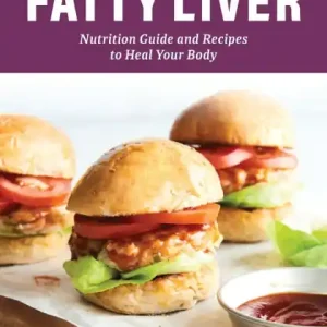 Direct From Manufacturer The Essential Diet for Fatty Liver: Nutrition Guide and Recipes to Heal Your Body